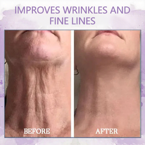 𝐅𝐢𝐧𝐚𝐥 𝐃𝐚𝐲 𝐒𝐚𝐯𝐢𝐧𝐠𝐬: 80% 𝐎𝐅𝐅 - Ultra Firming & Revitalizing Cream: Renew Skin Firmness💦
