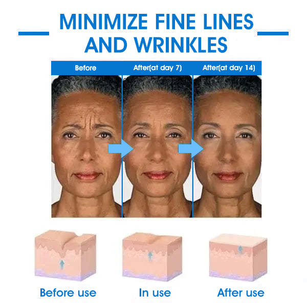 𝐅𝐢𝐧𝐚𝐥 𝐃𝐚𝐲 𝐒𝐚𝐯𝐢𝐧𝐠𝐬: 80% 𝐎𝐅𝐅 - Ultra Firming & Revitalizing Cream: Renew Skin Firmness💦