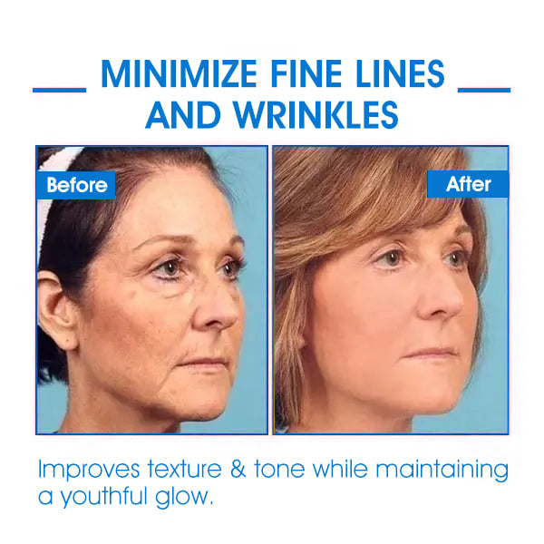 𝐅𝐢𝐧𝐚𝐥 𝐃𝐚𝐲 𝐒𝐚𝐯𝐢𝐧𝐠𝐬: 80% 𝐎𝐅𝐅 - Ultra Firming & Revitalizing Cream: Renew Skin Firmness💦