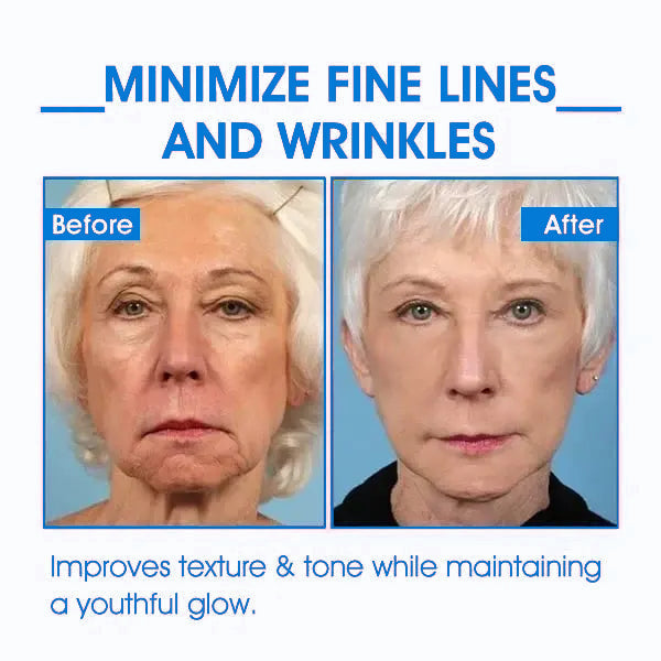 𝐅𝐢𝐧𝐚𝐥 𝐃𝐚𝐲 𝐒𝐚𝐯𝐢𝐧𝐠𝐬: 80% 𝐎𝐅𝐅 - Ultra Firming & Revitalizing Cream: Renew Skin Firmness💦