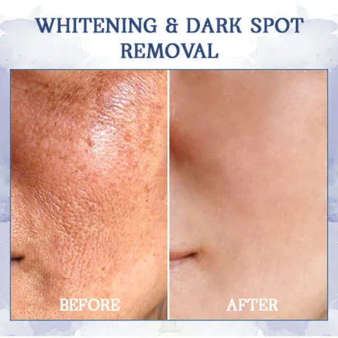 𝐋𝐚𝐬𝐭 𝐃𝐚𝐲 𝐃𝐢𝐬𝐜𝐨𝐮𝐧𝐭: ✨🩵𝟕𝟎% 𝐎𝐅𝐅🌸𝐅𝐮𝐛𝐬𝐭𝐚® 𝐀𝐝𝐯𝐚𝐧𝐜𝐞𝐝 𝐅𝐢𝐫𝐦𝐢𝐧𝐠 & 𝐖𝐫𝐢𝐧𝐤𝐥𝐞-𝐑𝐞𝐝𝐮𝐜𝐢𝐧𝐠 𝐂𝐫𝐞𝐚𝐦: Restore Skin Elasticity⭐