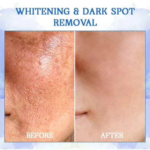 𝐅𝐢𝐧𝐚𝐥 𝐃𝐚𝐲 𝐒𝐚𝐯𝐢𝐧𝐠𝐬: 80% 𝐎𝐅𝐅 - Ultra Firming & Revitalizing Cream: Renew Skin Firmness💦