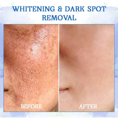 𝐅𝐢𝐧𝐚𝐥 𝐃𝐚𝐲 𝐒𝐚𝐯𝐢𝐧𝐠𝐬: 80% 𝐎𝐅𝐅 - Ultra Firming & Revitalizing Cream: Renew Skin Firmness💦